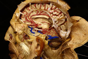 Neurosurgery